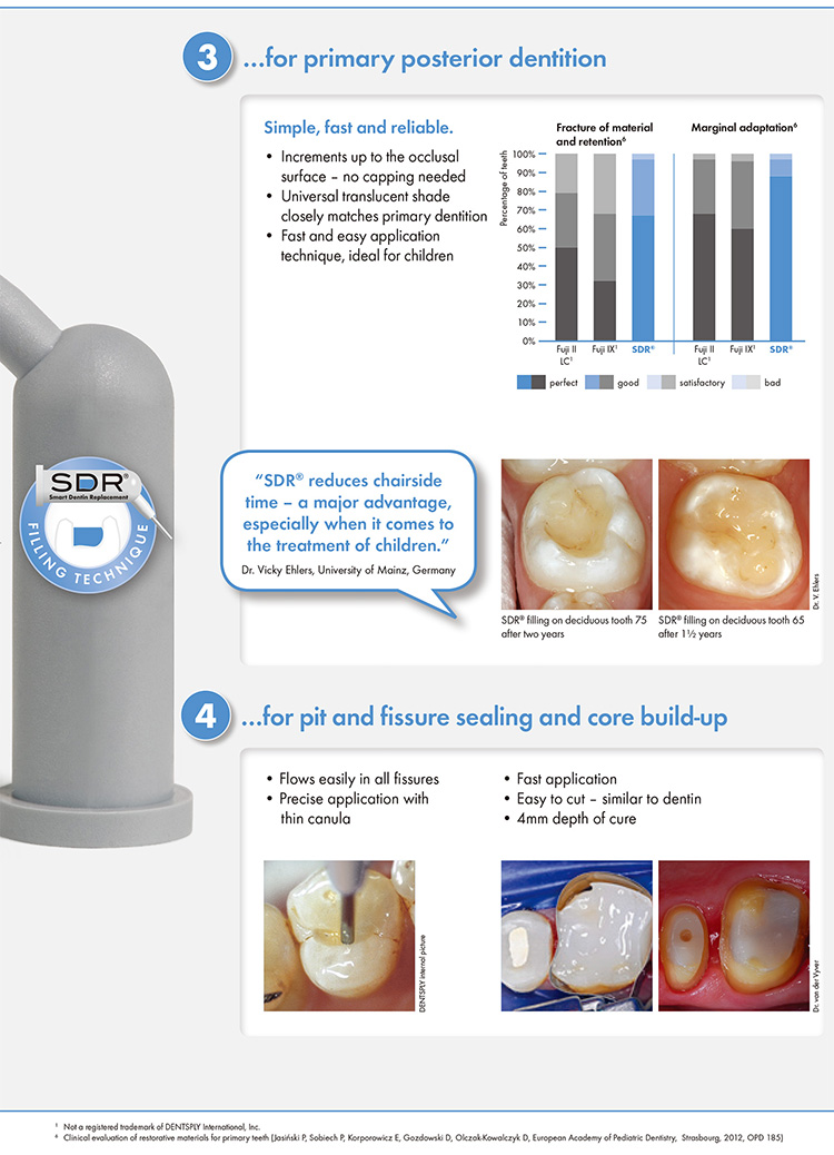 SDR Smart Dentin Replacement
